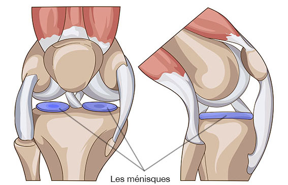 Les ménisques - Dr Clavé Arnaud