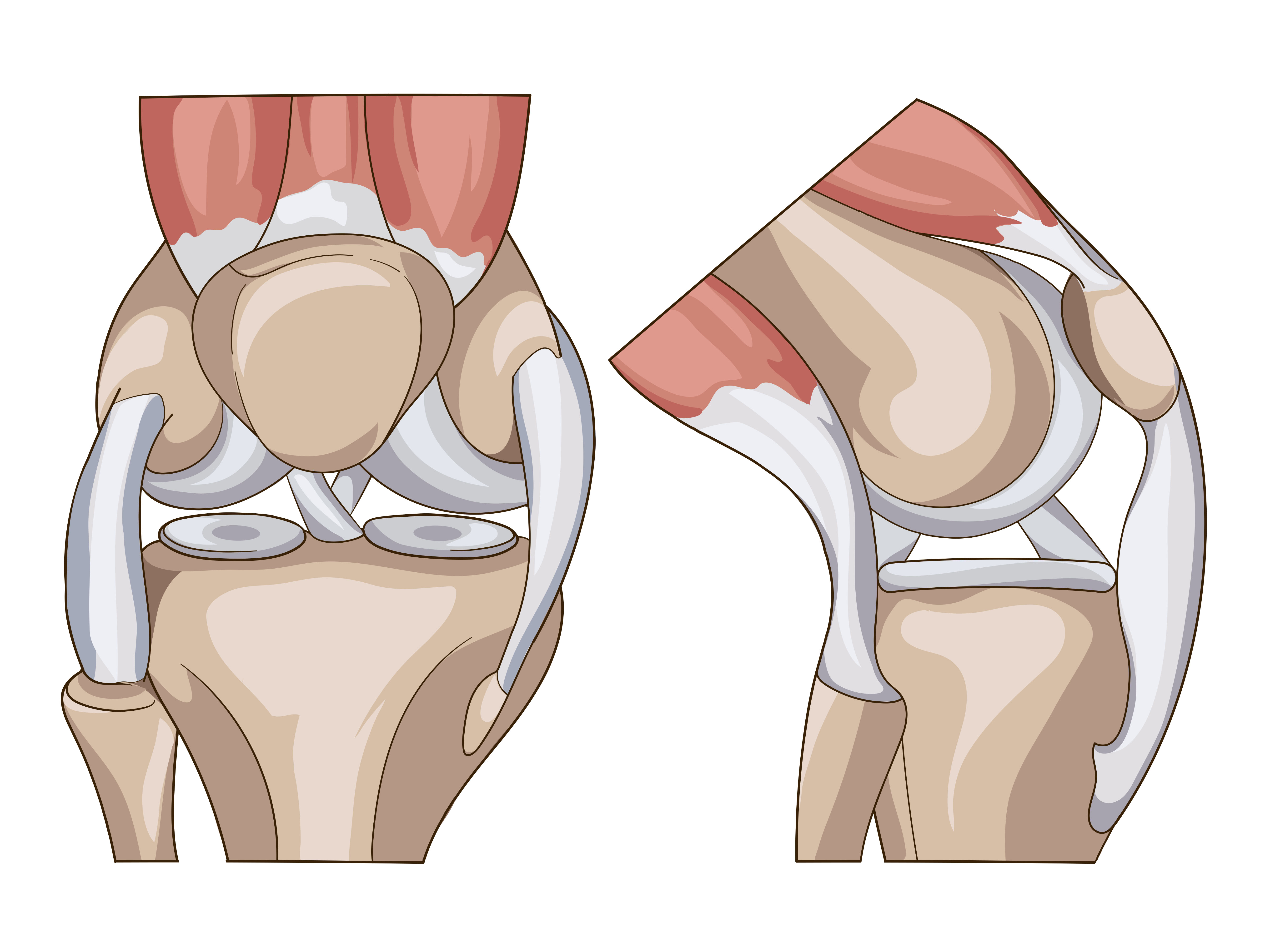 Связка мениска колена. Коленный мениск анатомия. Мениски коленного сустава анатомия разрыв. Разрыв мениска коленного сустава 3 степени. Анатомия латерального мениска коленного сустава.
